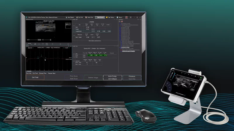 Transdutor Linear InVisus Pro PR52 6-18MHz 256 Elementos