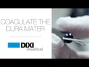 Dura mater Coagulation