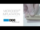 MICRODEEP® implantation