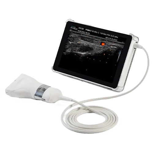 [E310-044822] Ultrassonografia Natus InVisus Pro
